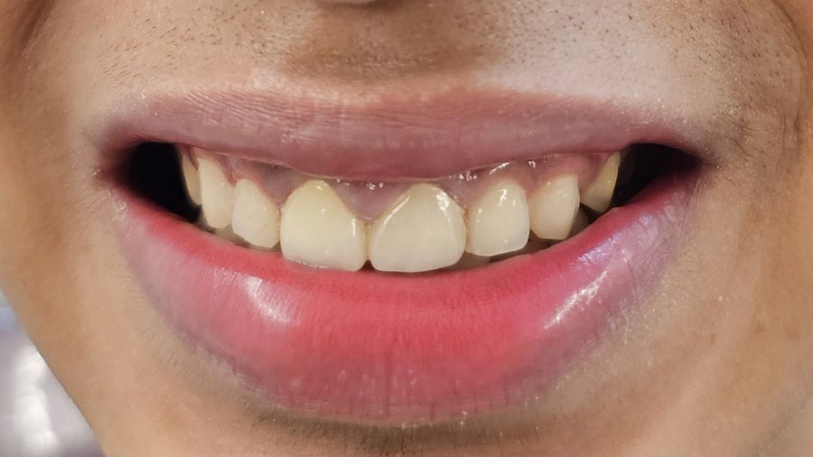 Close-up of a patient smiling