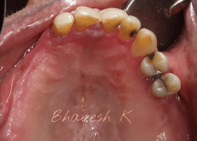 Before and after: dental work showcase